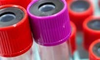 Half of labs to be on NPEx