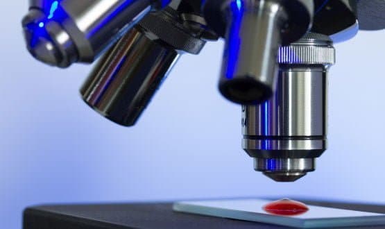 Shared digital pathology network set-up in the north