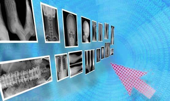 The bigger picture: sharing PACs images