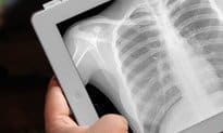 UK dose registry ‘at planning stage’