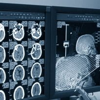 Trusts urged to think PACS/RIS 24/7