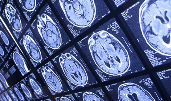 25,000 patient radiology records affected in HSE computer system