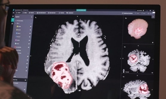 Microsoft to drive ‘intelligent health’ with new AI, cloud computing projects