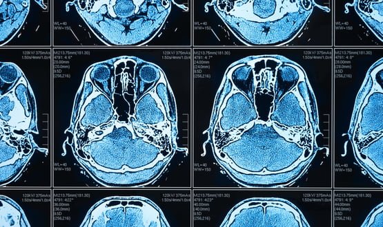 Oxford imaging firm lends AI smarts to £50m government initiative