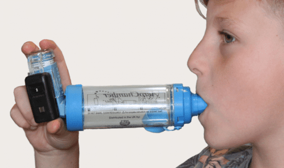 Asthma app monitors children’s symptoms to reduce risk of attacks