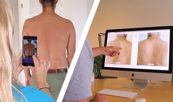 Apps valuable tools for skin cancer self-monitoring, say dermatologists