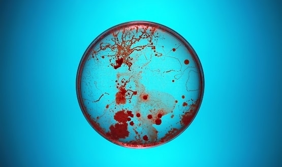 AI identifies new antibiotic that can kill drug-resistant bacteria