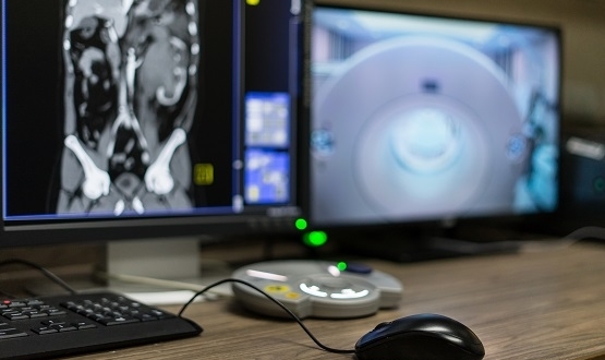 Rhino Health joins consortium to reduce carbon footprint of CT scans