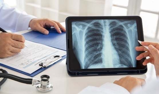 X-rays on your high street – a first line of care for the NHS?
