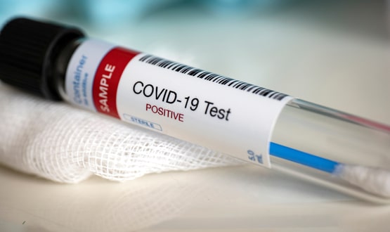 Investigation launched after IT error misses thousands of Covid-19 cases