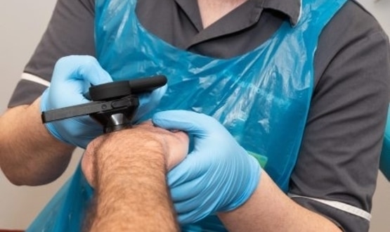 Chelsea and Westminster Hospital trials AI skin cancer diagnostic tool