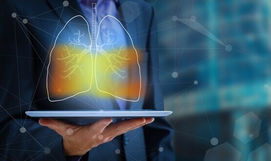Clinithink and AstraZeneca launch AI project for lung cancer detection