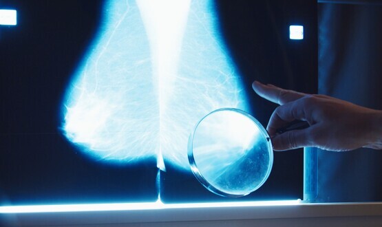 AI can be utilized safely in breast most cancers screening