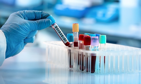 Community Diagnostic Centres deliver over seven million vital checks