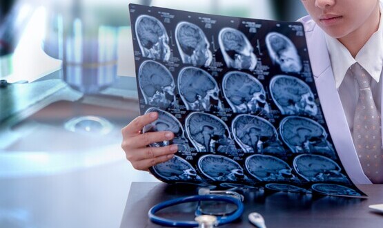 Re:Cognition Health opens concussion clinic featuring brain-scanning tech