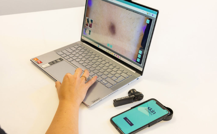 Hand typing on laptop next to a smartphone showing Skin Analytics app