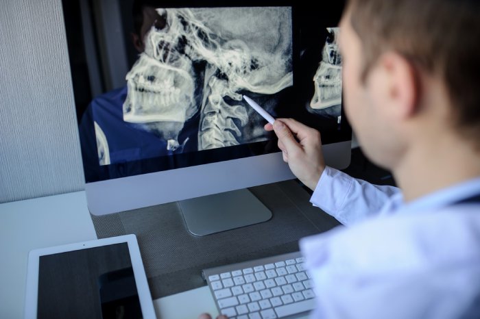 Radiologist viewing a scan image on a screen